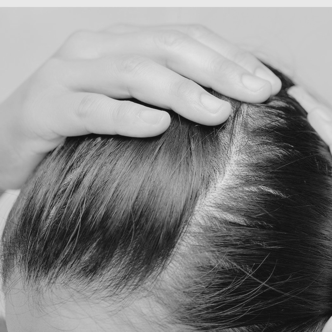 "Scalp Care 101: Your Path to Beautiful, Flake-Free Hair"